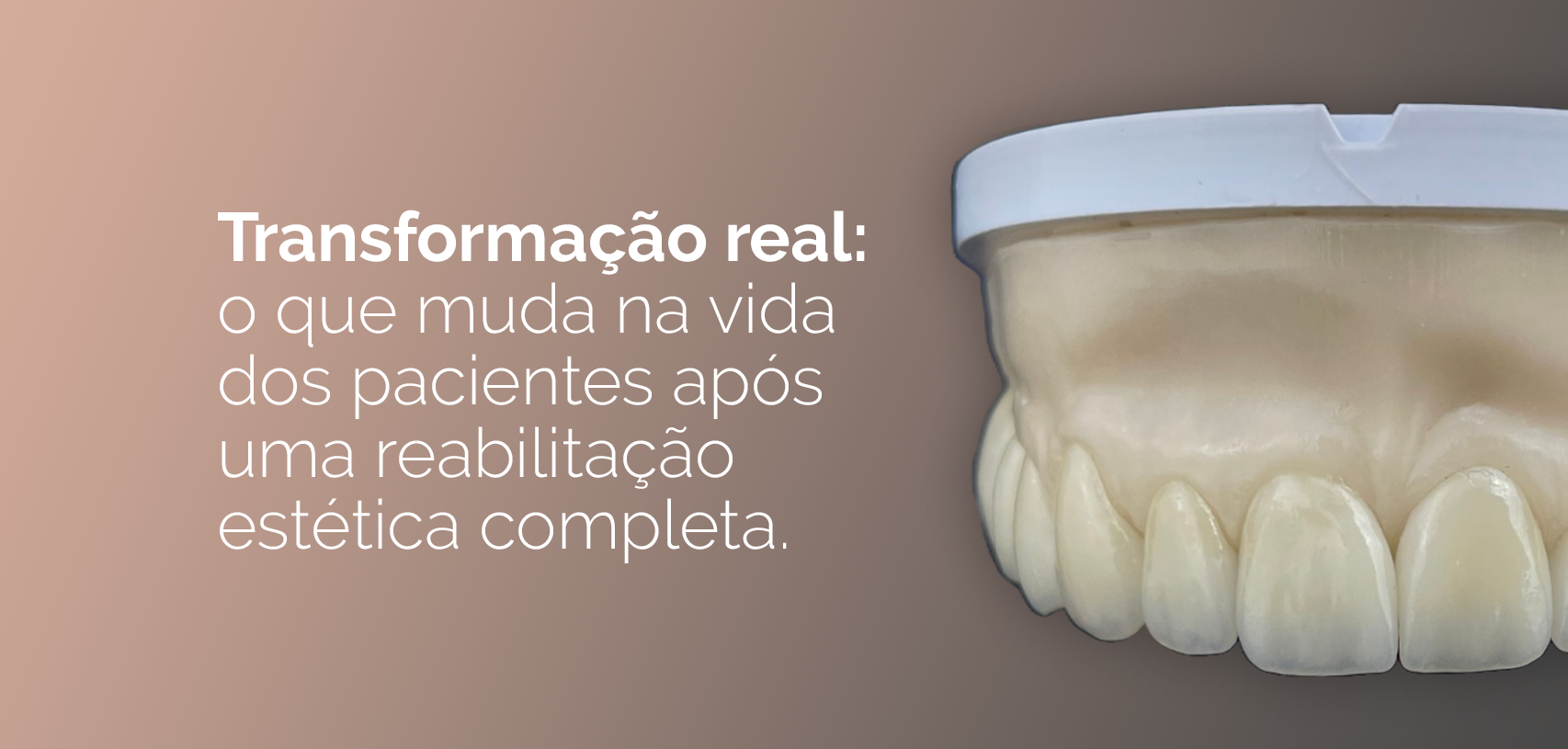 Transformação real: o que muda na vida dos pacientes após uma reabilitação estética completa